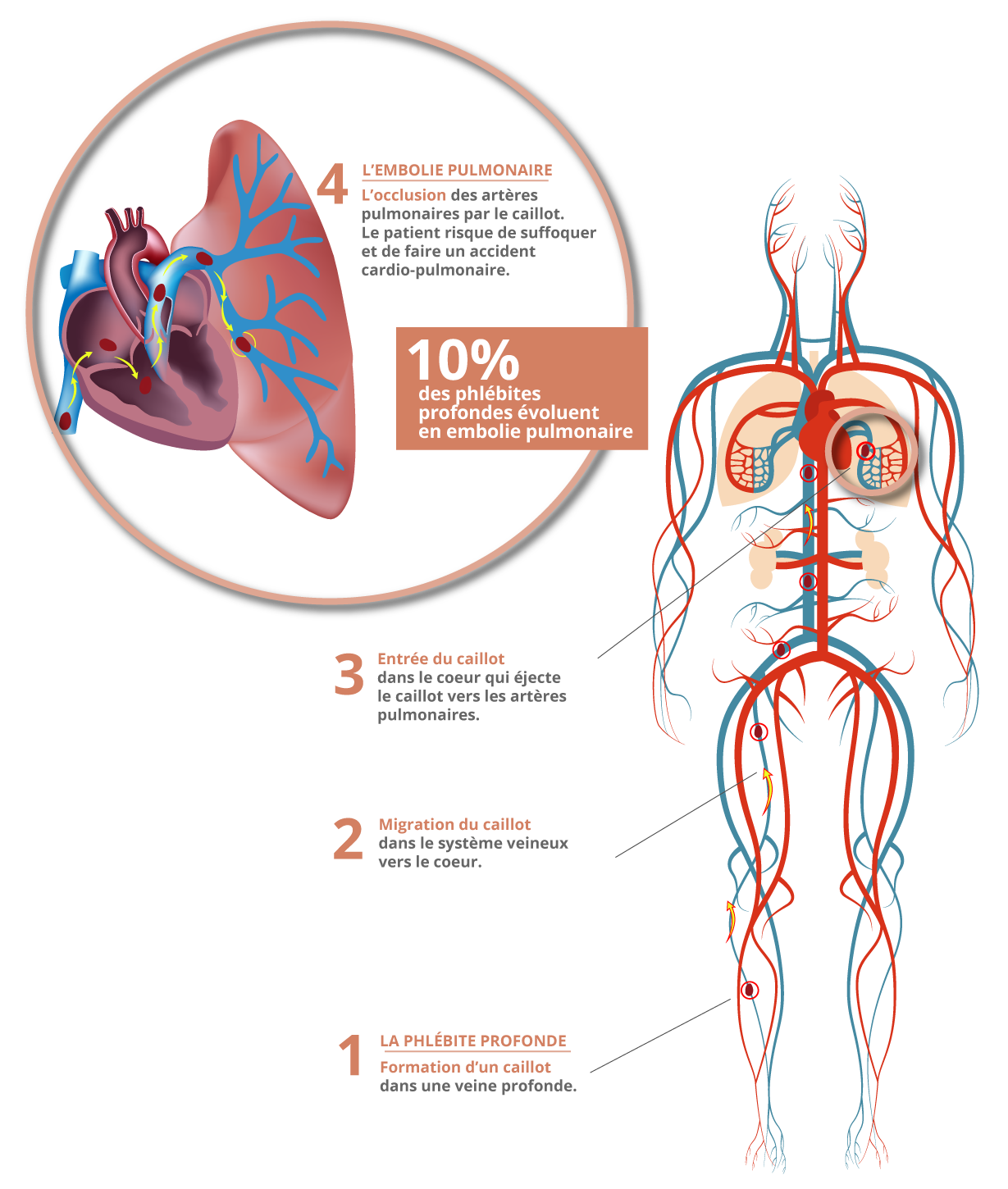 simptome varicoza interna pelvis