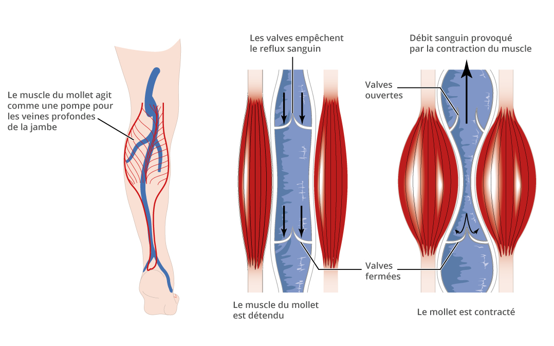 Psihosomatica varicoza vene