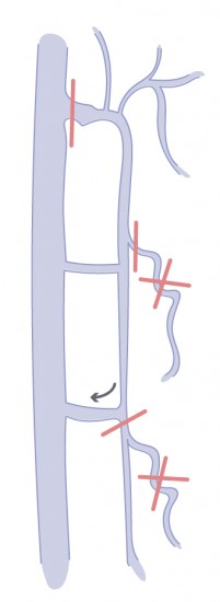hemodynamique